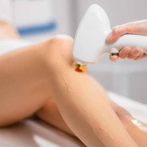 Body hair removal treatment