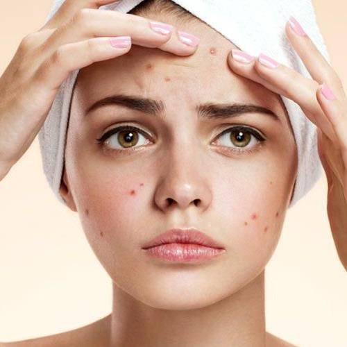 Acne scar treatment