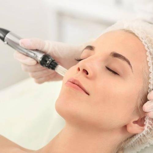 Hair Micro needling Treatment