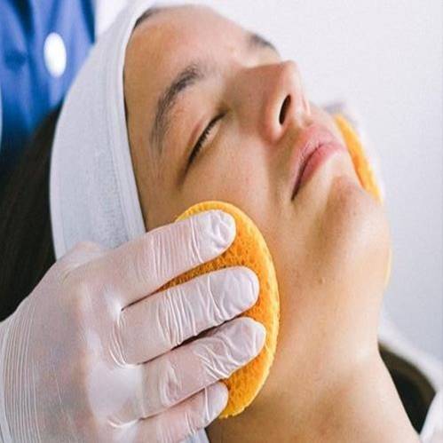 Chemical Peels treatment